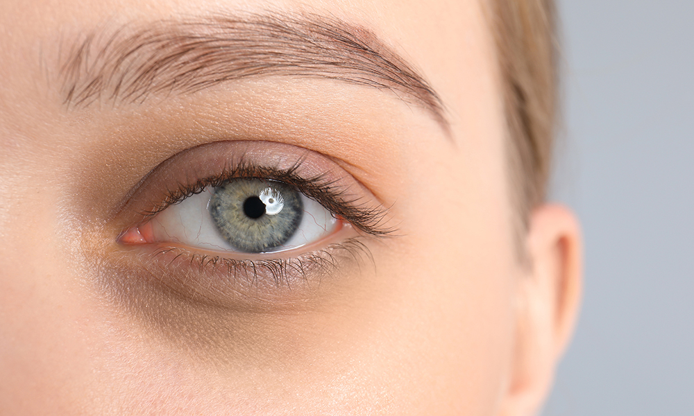 Tired young woman with dark circle under eye, closeup